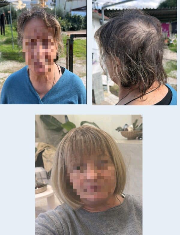 Γυναικείο Topper Τουπέ κορυφής μαλλιών με κλιπ μεγάλης επιφάνειας με Lace Front (διαφάνεια )- Ξανθό με σκούρη ρίζα 19 inches - Image 4