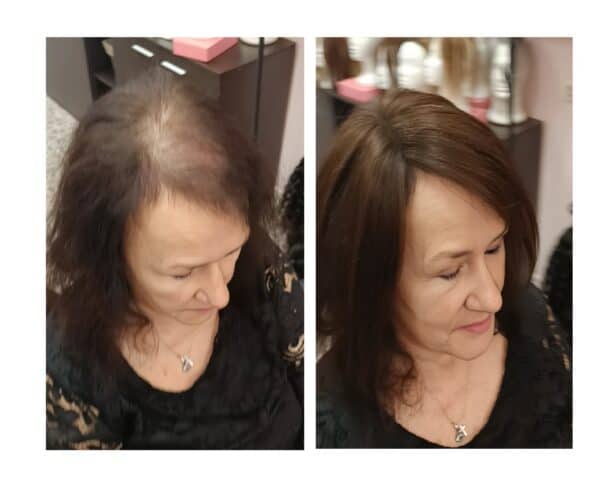 Γυναικείο Topper Τουπέ κορυφής μαλλιών από φυσική τρίχα  Full lace ( ραμμένο σε διαφάνεια ) - Καστανό σκούρο Brown 12 inches - Image 2