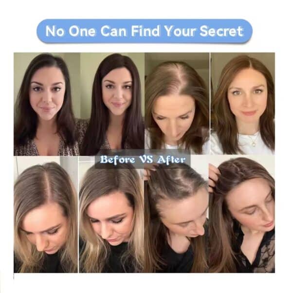 Γυναικείο Topper Τουπέ κορυφής μαλλιών από φυσική τρίχα  - Γκρι ανοιχτό λευκό 10 inches - Image 3